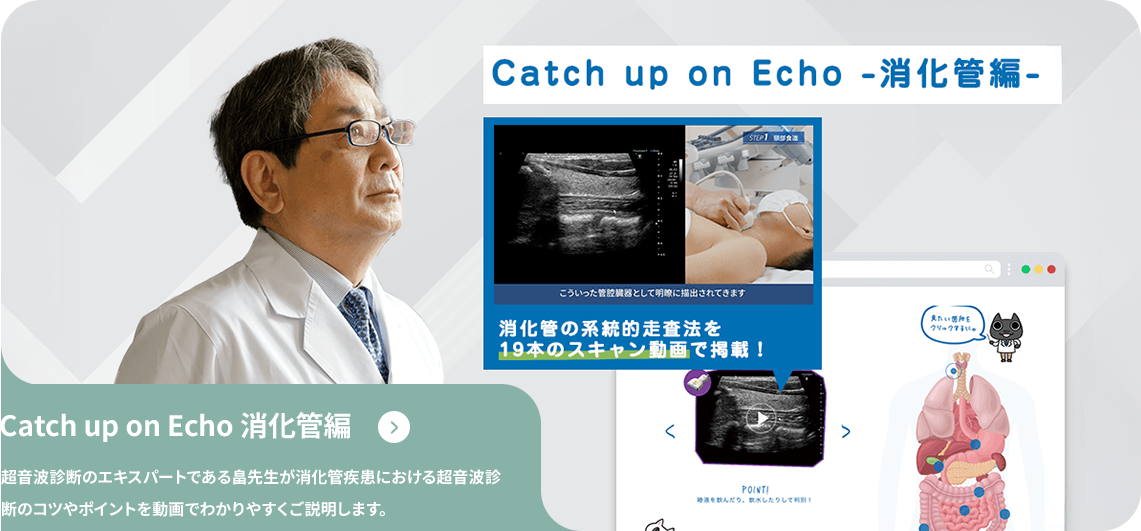 Catch up on Echo 消化器官編 超音波診断のエキスパートである畠先生が消化管疾患における超音波診断のコツやポイントを動画でわかりやすくご説明します。