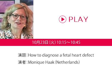 演題：How to diagnose a fetal heart defect　演者：Monique Haak（Netherlands）