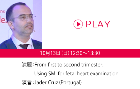 演題：From first to second trimester:Using SMI for fetal heart examination　演者：Jader Cruz（Portugal）