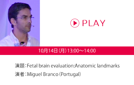 演題：Fetal brain evaluation:Anatomic landmarks　演者：Miguel Branco（Portugal）