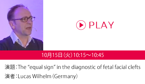 演題：The “equal sign” in the diagnostic of fetal facial clefts　演者：Lucas Wilhelm（Germany）
