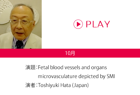 演題：Fetal blood vessels and organs microvasculature depicted by SMI 演者：Toshiyuki Hata (Japan)