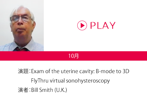 演題：Exam of the uterine cavity: B-mode to 3D FlyThru virtual sonohysteroscopy 演者：Bill Smith (U.K.)