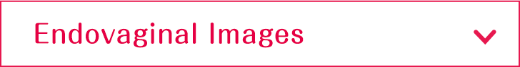 Endovaginal Images