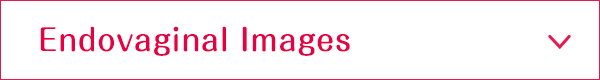 Endovaginal Images
