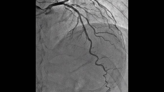 The Angiography Atlas 血管造影 新血管造影アトラス - メルカリ