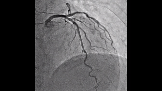 The Angiography Atlas 血管造影 血管造影 | 画像診断センター | 部門 | 診療科・部門 | 聖隷横浜病院